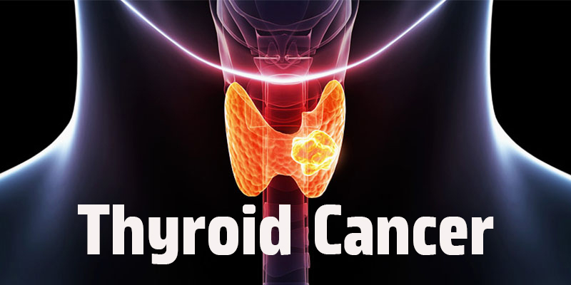 thyroid cancer disease